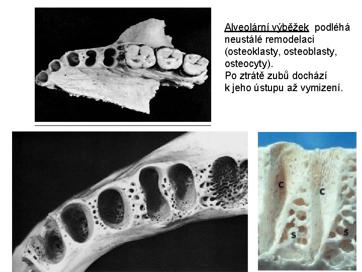 Alveolární výběžek podléhá neustálé remodelaci (osteoklasty, osteoblasty, osteocyty). Po ztrátě zubů dochází k jeho