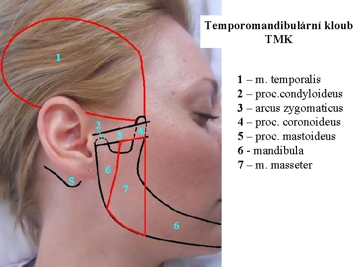 Temporomandibulární kloub TMK 1 – m. temporalis 2 – proc. condyloideus 3 – arcus