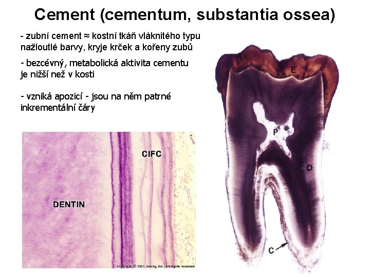 Cement (cementum, substantia ossea) - zubní cement ≈ kostní tkáň vláknitého typu nažloutlé barvy,