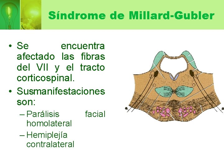 Síndrome de Millard-Gubler • Se encuentra afectado las fibras del VII y el tracto