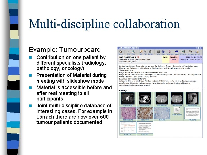 Multi-discipline collaboration Example: Tumourboard Contribution on one patient by different specialists (radiology, pathology, oncology)