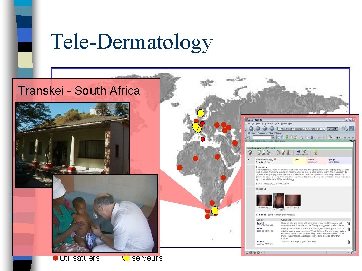 Tele-Dermatology Transkei - South Africa Clinic Case on i. Path Utilisatuers serveurs 
