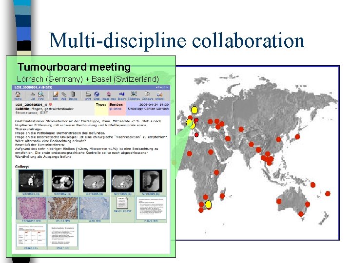 Multi-discipline collaboration Tumourboard meeting Lörrach (Germany) + Basel (Switzerland) Utilisatuers serveurs 