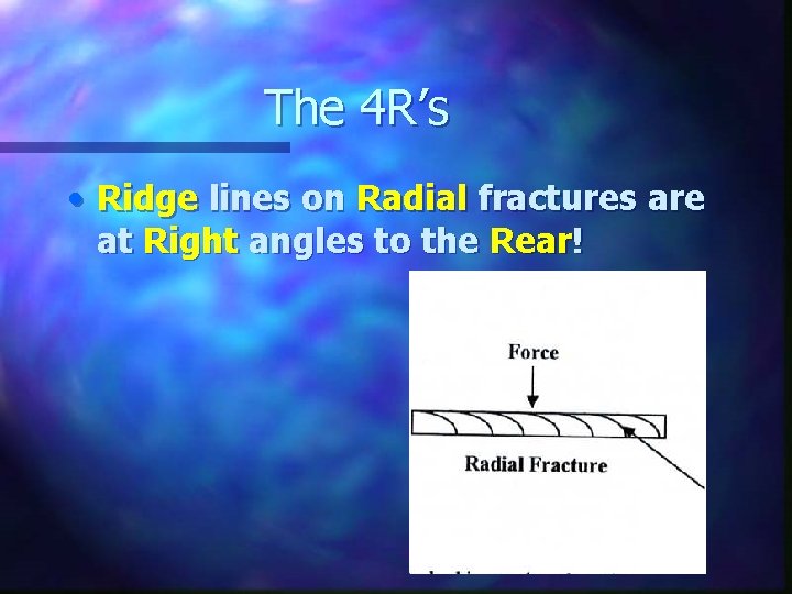 The 4 R’s • Ridge lines on Radial fractures are at Right angles to