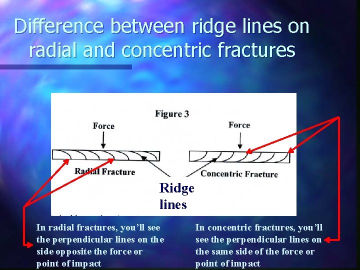 Difference between ridge lines on radial and concentric fractures Ridge lines In radial fractures,