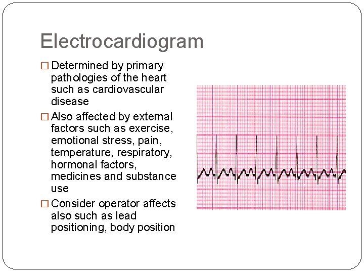 Electrocardiogram � Determined by primary pathologies of the heart such as cardiovascular disease �