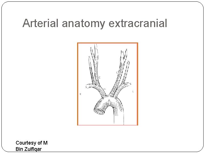 Arterial anatomy extracranial Courtesy of M Bin Zulfiqar 