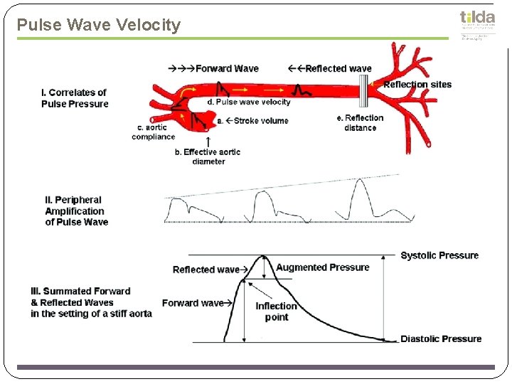 Pulse Wave Velocity 