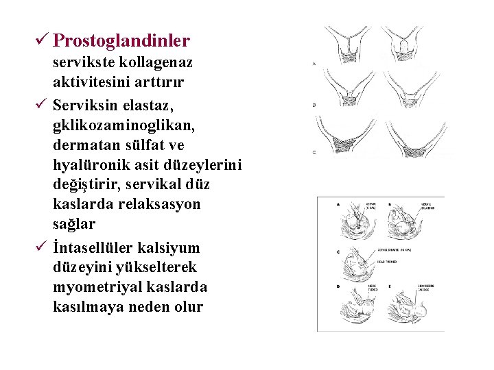 ü Prostoglandinler servikste kollagenaz aktivitesini arttırır ü Serviksin elastaz, gklikozaminoglikan, dermatan sülfat ve hyalüronik