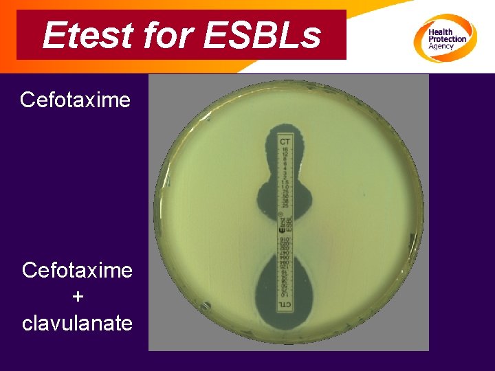 Etest for ESBLs Cefotaxime + clavulanate 
