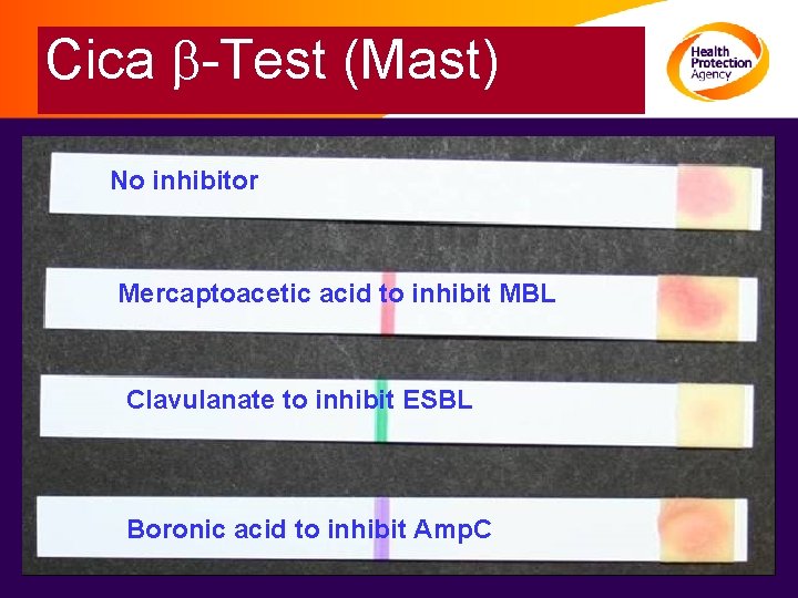 Cica b-Test (Mast) No inhibitor Mercaptoacetic acid to inhibit MBL Clavulanate to inhibit ESBL