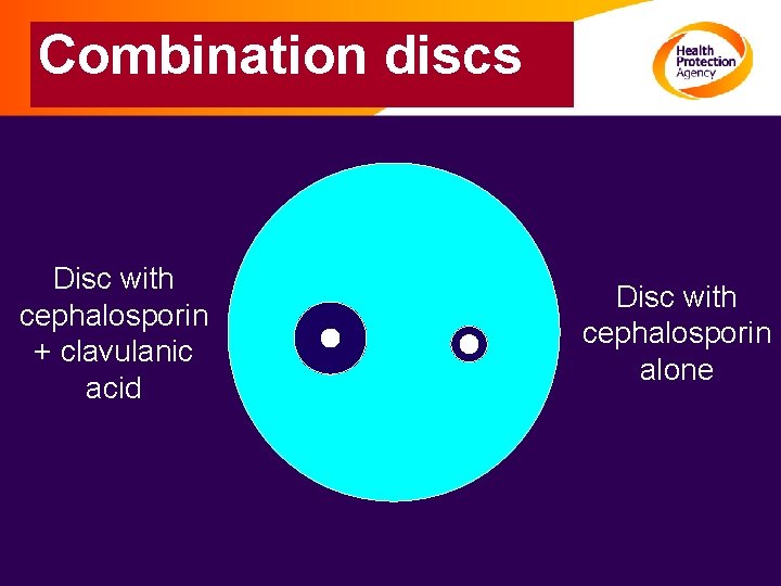 Combination discs Disc with cephalosporin + clavulanic acid Disc with cephalosporin alone 