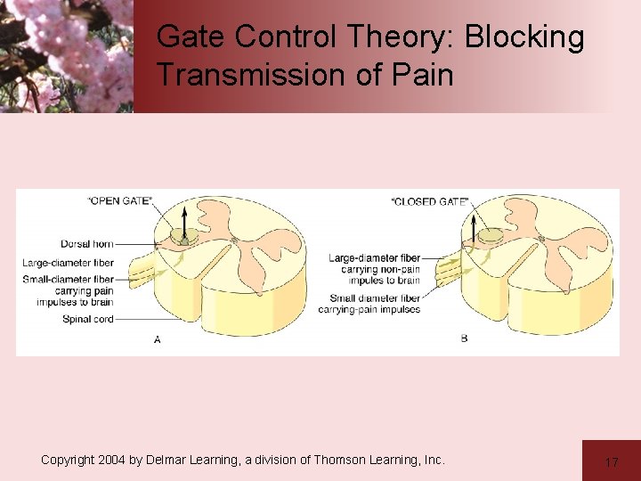 Gate Control Theory: Blocking Transmission of Pain Copyright 2004 by Delmar Learning, a division