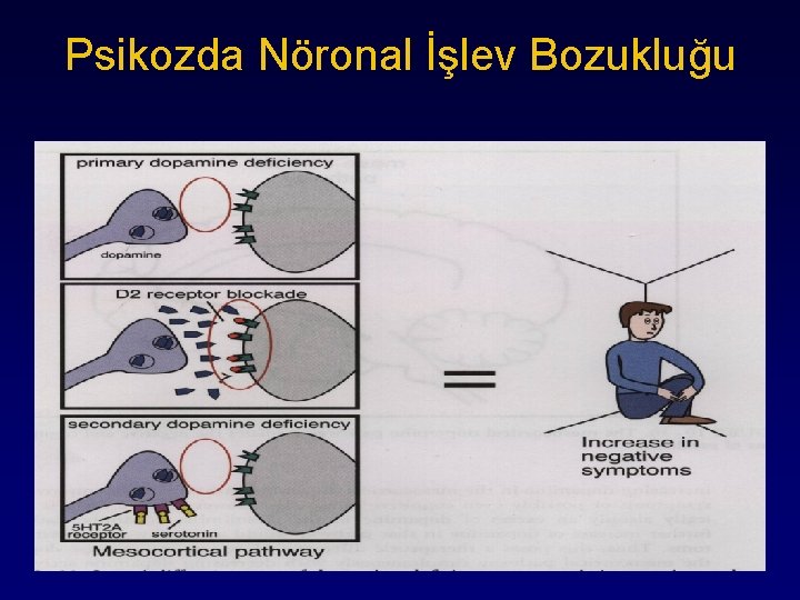 Psikozda Nöronal İşlev Bozukluğu 