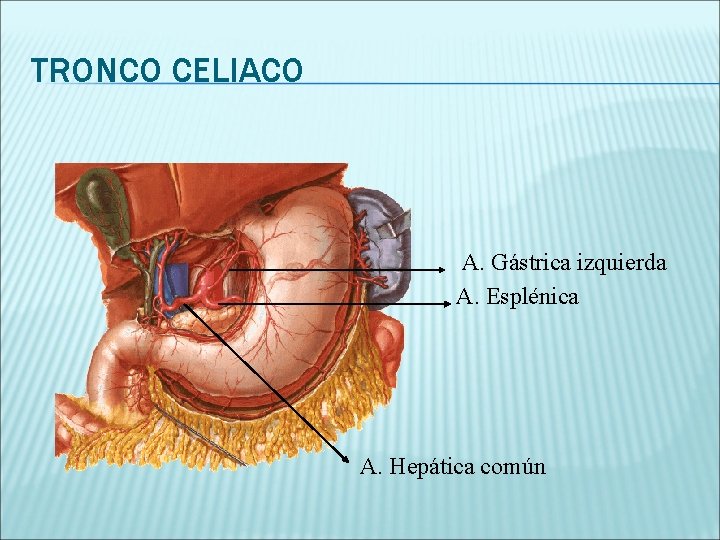 TRONCO CELIACO A. Gástrica izquierda A. Esplénica A. Hepática común 