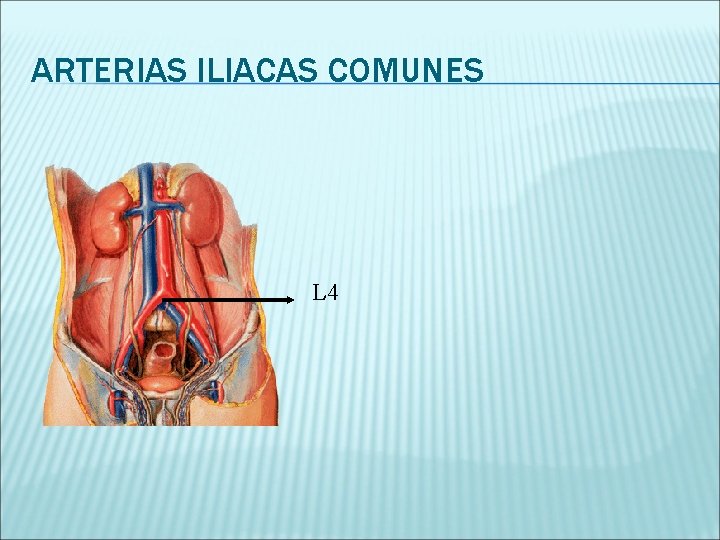 ARTERIAS ILIACAS COMUNES L 4 