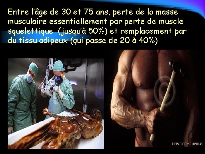 Entre l’âge de 30 et 75 ans, perte de la masse musculaire essentiellement par