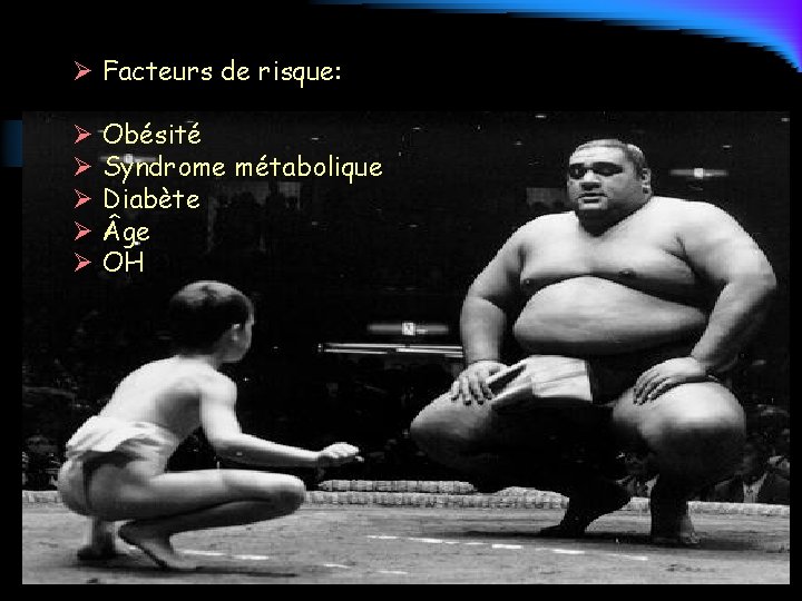 Ø Facteurs de risque: Ø Obésité Ø Syndrome métabolique Ø Diabète Ø ge Ø