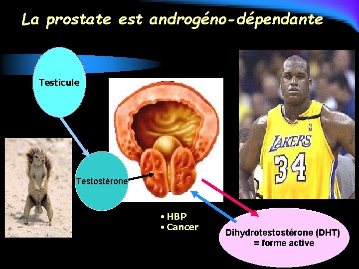 La prostate est androgéno-dépendante Testicule Testostérone • HBP • Cancer Dihydrotestostérone (DHT) = forme