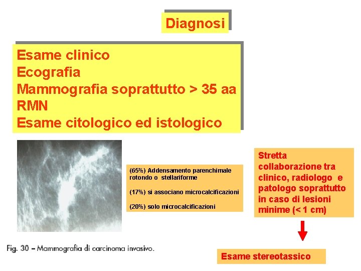 Diagnosi Esame clinico Ecografia Mammografia soprattutto > 35 aa RMN Esame citologico ed istologico