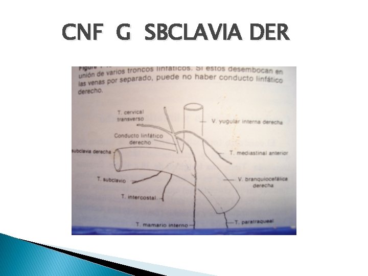 CNF G SBCLAVIA DER 