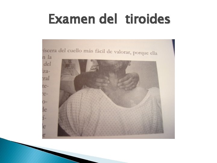 Examen del tiroides 