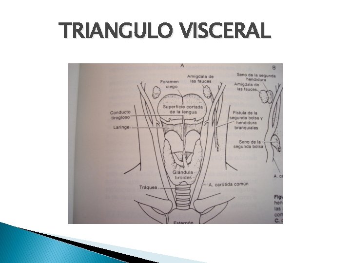 TRIANGULO VISCERAL 