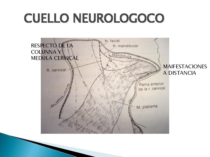 CUELLO NEUROLOGOCO RESPECTO DE LA COLUNNA Y MEDULA CERVICAL MAIFESTACIONES A DISTANCIA 