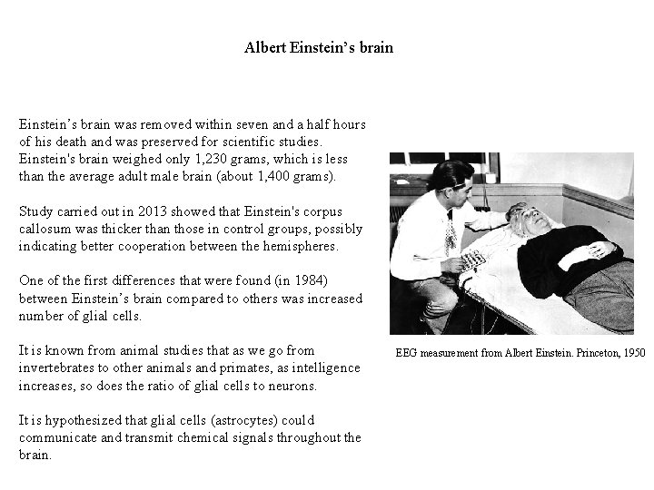 Albert Einstein’s brain was removed within seven and a half hours of his death