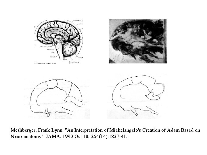 Meshberger, Frank Lynn. "An Interpretation of Michelangelo's Creation of Adam Based on Neuroanatomy", JAMA.