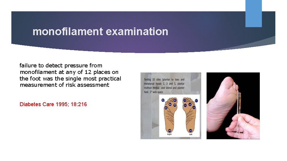  monofilament examination failure to detect pressure from monofilament at any of 12 places