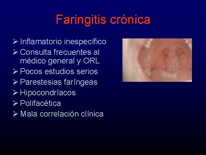 Faringitis crónica Ø Inflamatorio inespecífico Ø Consulta frecuentes al médico general y ORL Ø