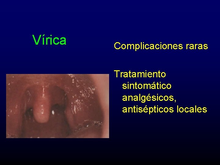 Vírica Complicaciones raras Tratamiento sintomático analgésicos, antisépticos locales 