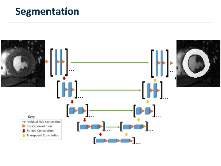 Segmentation 