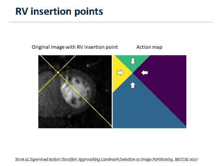 RV insertion points Xu et al. Supervised Action Classifier: Approaching Landmark Detection as Image