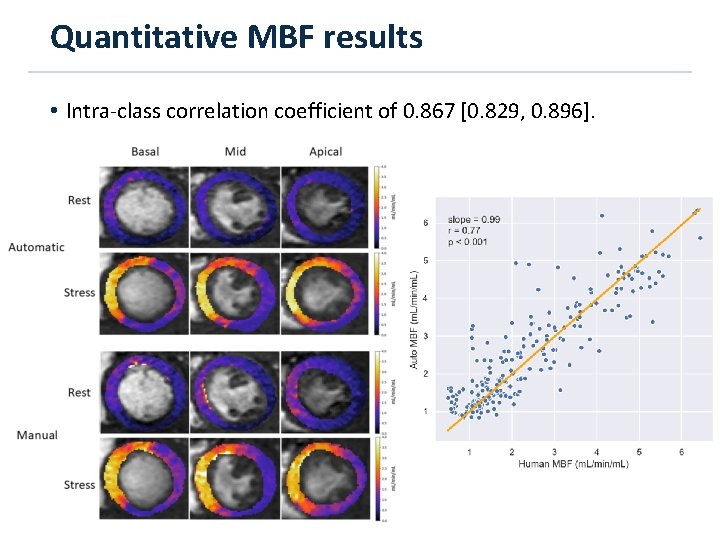 Quantitative MBF results • Intra-class correlation coefficient of 0. 867 [0. 829, 0. 896].