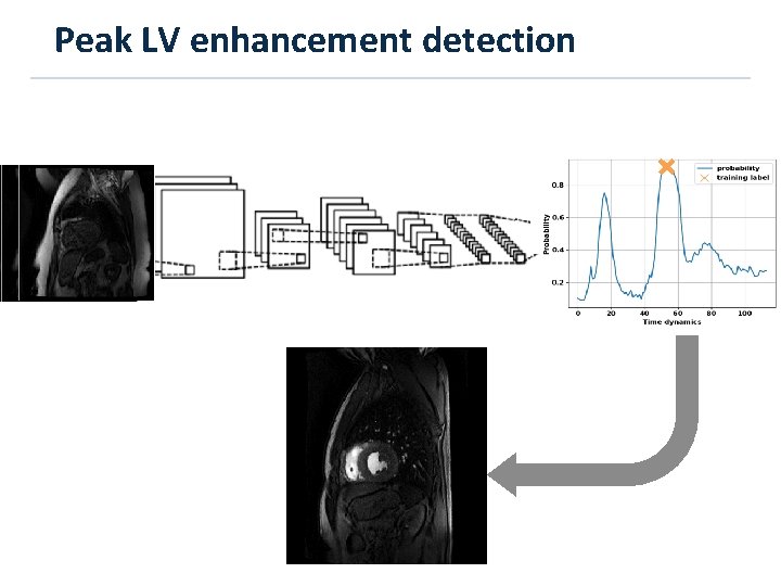 Peak LV enhancement detection 