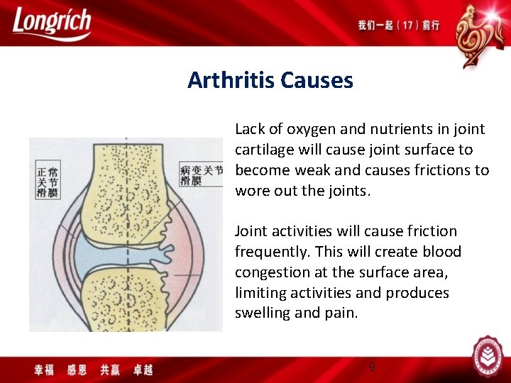 Arthritis Causes Lack of oxygen and nutrients in joint cartilage will cause joint surface