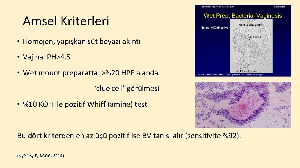 Amsel Kriterleri • Homojen, yapışkan süt beyazı akıntı • Vajinal PH>4. 5 • Wet