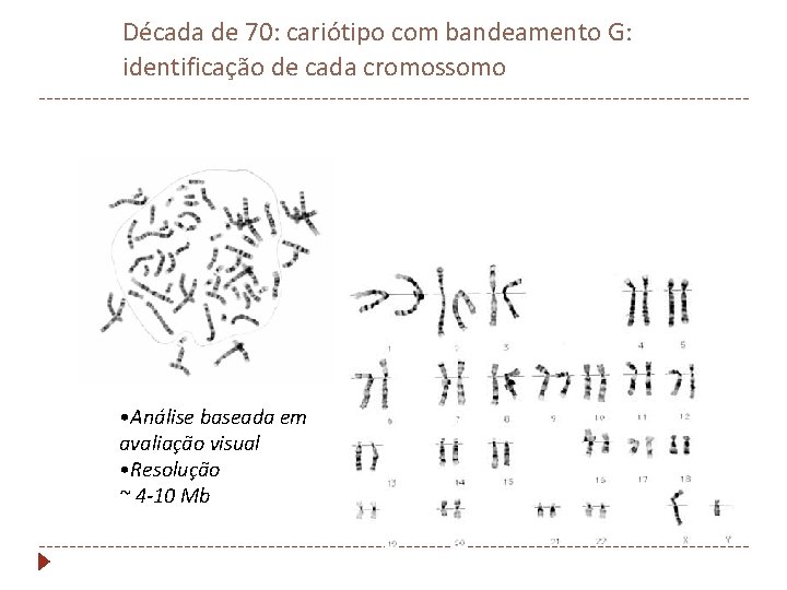 Década de 70: cariótipo com bandeamento G: identificação de cada cromossomo • Análise baseada