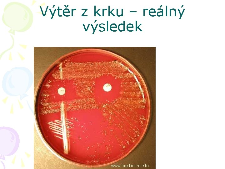 Výtěr z krku – reálný výsledek www. medmicro. info 