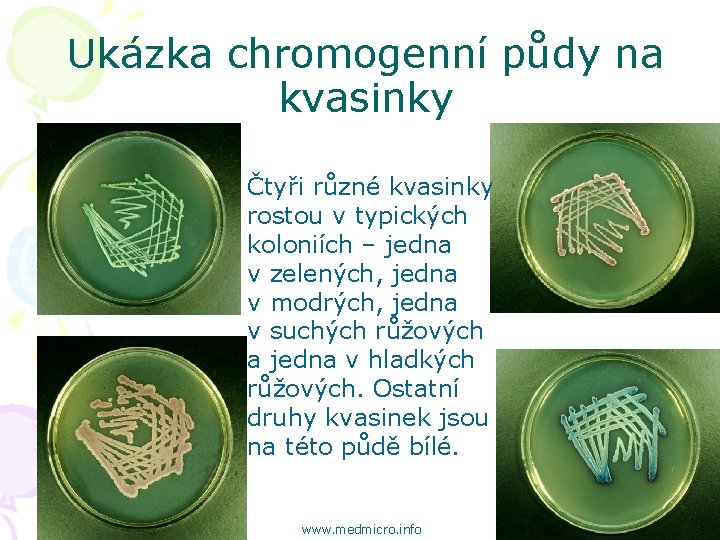 Ukázka chromogenní půdy na kvasinky Čtyři různé kvasinky rostou v typických koloniích – jedna