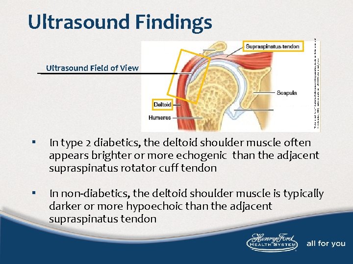 Ultrasound Field of View “Subacromial Bursa. ” Academic Dictionaries and Encyclopedias, 2011, medicine. academic.