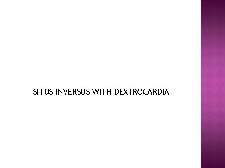 SITUS INVERSUS WITH DEXTROCARDIA 