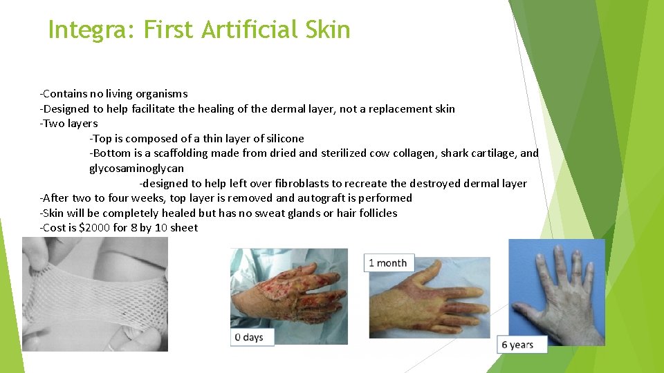 Integra: First Artificial Skin -Contains no living organisms -Designed to help facilitate the healing