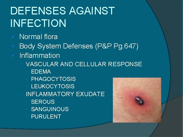 DEFENSES AGAINST INFECTION Normal flora Body System Defenses (P&P Pg. 647) Inflammation VASCULAR AND