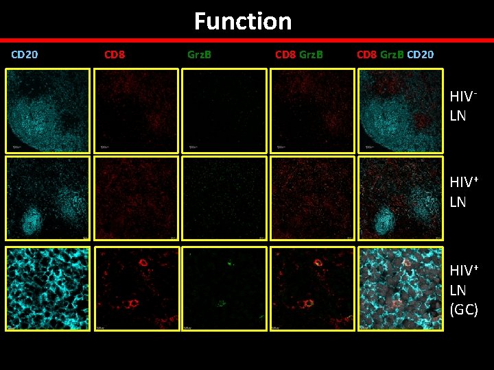 Function CD 20 CD 8 Grz. B CD 20 HIVLN HIV+ LN (GC) 