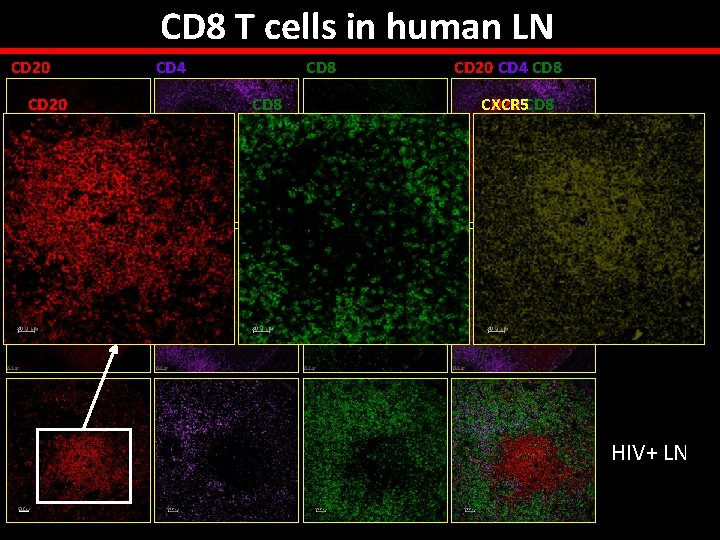 CD 8 T cells in human LN CD 20 CD 4 CD 8 CD