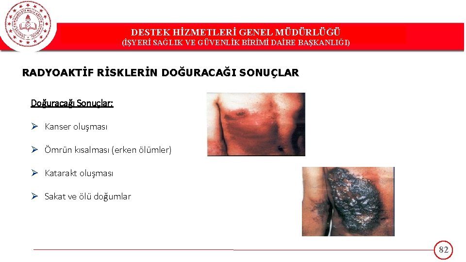 DESTEK HİZMETLERİ GENEL MÜDÜRLÜĞÜ DESTEK(İŞYERİ HİZMETLERİ GENEL MÜDÜRLÜĞÜ SAĞLIK VE GÜVENLİK BİRİMİ DAİRE BAŞKANLIĞI)