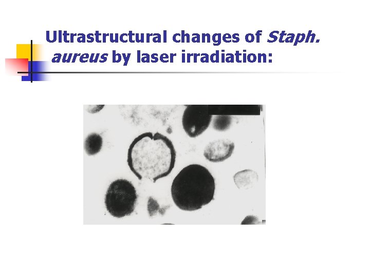 Ultrastructural changes of Staph. aureus by laser irradiation: 